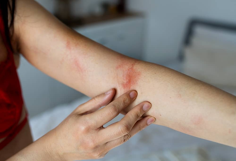 Physical Health Signs of Dry Air